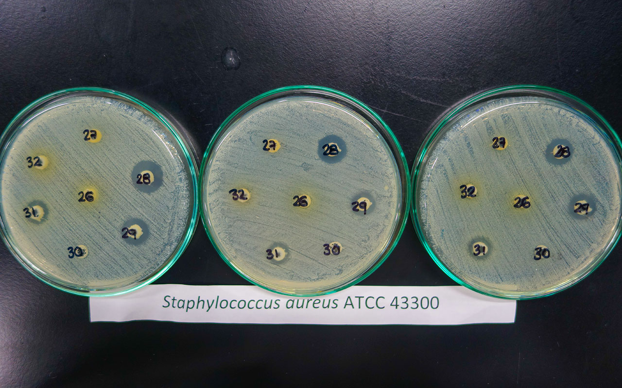 Foto de bacterias de trabajo en BIM 